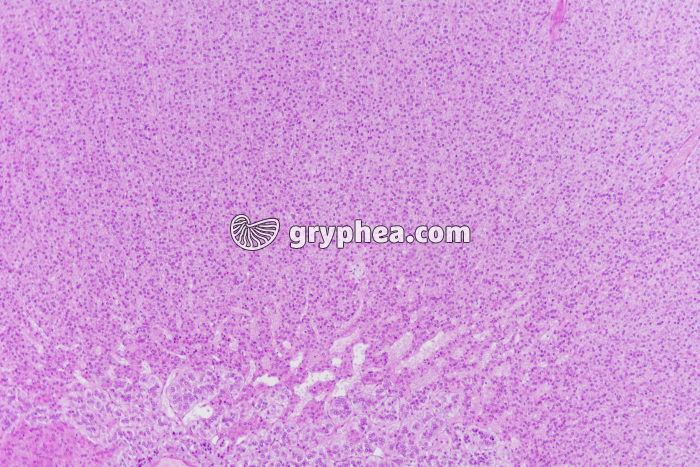 Surrénale - Capsule surrénale (zones fasciculée et réticulée de la zone corticale, en haut, et zone médullaire, en bas) x25 - gryphea.com